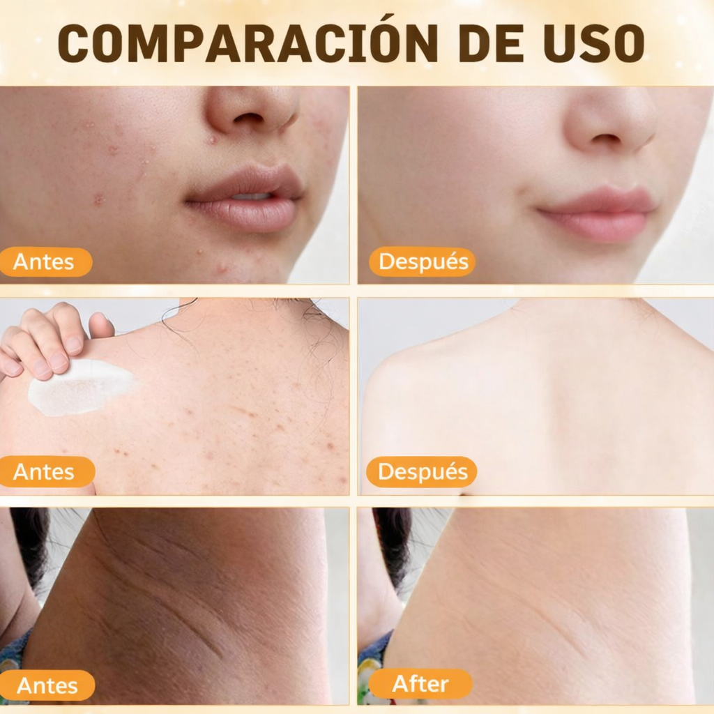 Bee Venom Comprehensive Cream